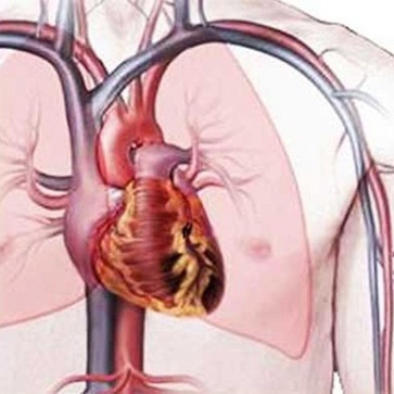 Nguy cơ tim mạch do tăng huyết áp và đái tháo đường