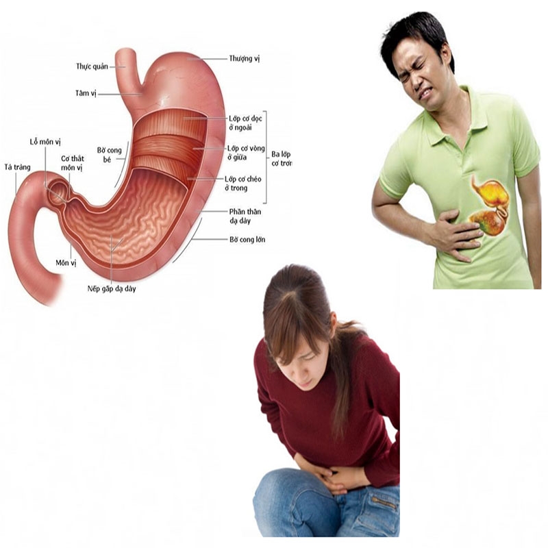 Tìm hiểu về bệnh viêm loét dạ dày - tá tràng